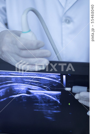 EPI dry needling ultrasound scan 55468040