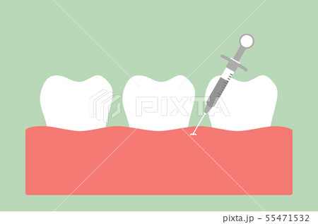dental injection for tooth extraction dental injection for tooth extraction 55471532