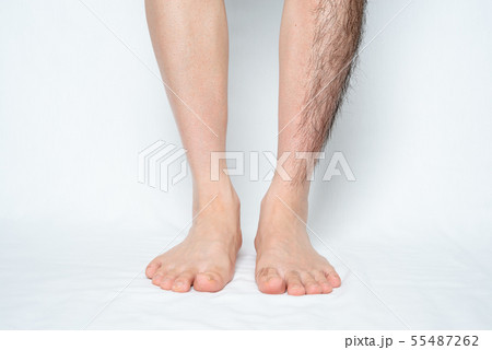 メンズ　脚脱毛　before & afterイメージ　部分のみ 55487262