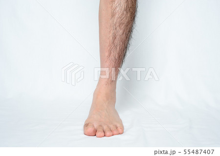 メンズ 脚脱毛 before & afterイメージ 片側のみ メンズ 脚脱毛 before & afterイメージ 片側のみ 55487407