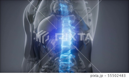 Backache in Back Bones 55502483