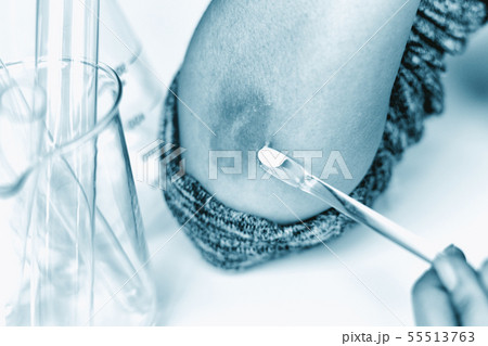 Skin allergy diseases problem, Close up. Skin allergy diseases problem, Close up. 55513763