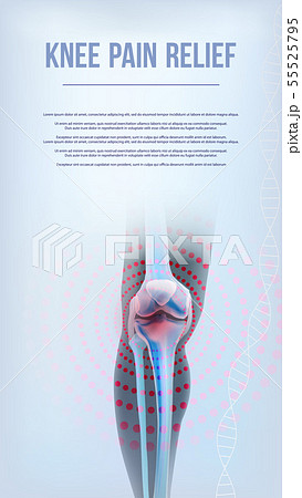 Bones the of knee pain relief 55525795