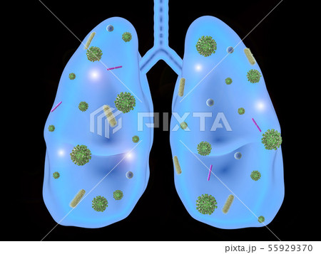 lung disease with bacteria cells 55929370