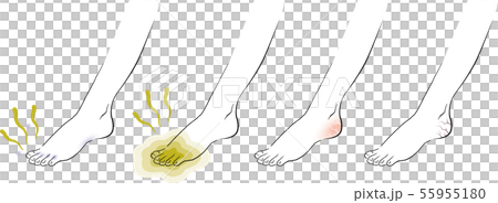 足のトラブル　フットケア 55955180