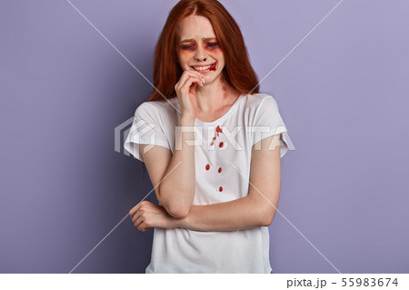 red-haired girl touching her lips, she has ugly bruises on face red-haired girl touching her lips, she has ugly bruises on face 55983674