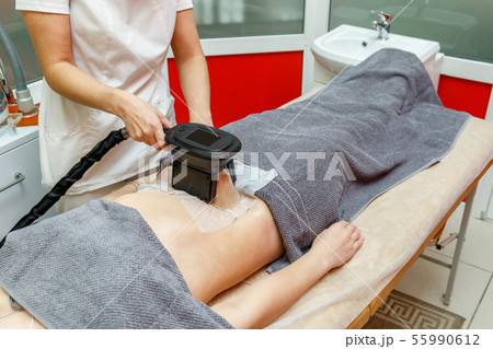 Cryolipolysis fat freezing treatment. Weight loss Cryolipolysis fat freezing treatment. Weight loss 55990612