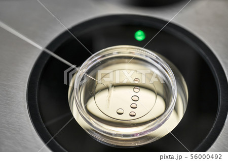 Process of in vitro fertilization in laboratory 56000492