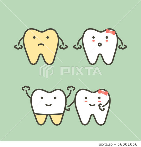 dental veneers or tooth whitening 56001056