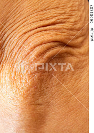 Asian senior woman's wrinkled elbow, Close up Asian senior woman's wrinkled elbow, Close up 56081807