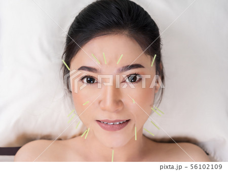 woman undergoing acupuncture treatment on face woman undergoing acupuncture treatment on face 56102109