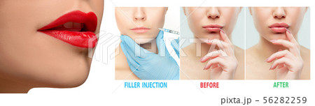 Beautiful female face, concept of skincare and lifting. Perfect lips. Beautiful female face, concept of skincare and lifting. Perfect lips. 56282259