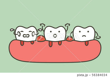 periodontitis or gum disease with bleeding 56384034