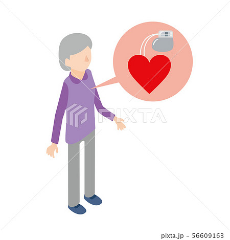ペースメーカー 心臓 心臓病 女性のイラスト素材 56609163 Pixta