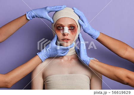 Young woman in bandages with bruises on her face looking at the camera Young woman in bandages with bruises on her face looking at the camera 56619629