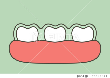 teeth wear silicone trainer or invisible braces 56623241