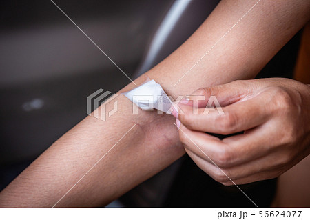 Closeup of cotton closed the wound after blood  56624077