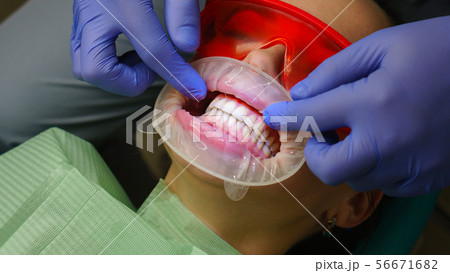 Girl patient in dental clinic 56671682