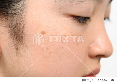 シミ シミ 56687136