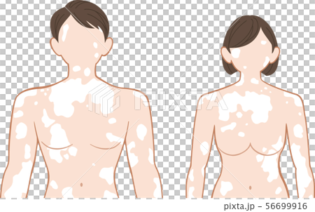 白斑　上半身　前　男女セット 56699916