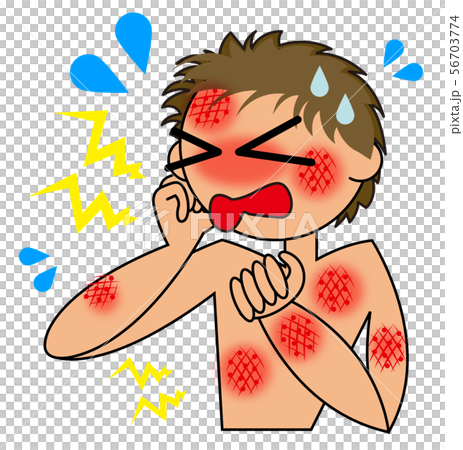皮膚炎のイラスト 皮膚炎のイラスト 56703774