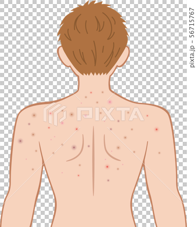 できもの　上半身　後ろ　男性 56715767