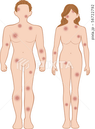 化膿　全身　前　男女セット 56722792