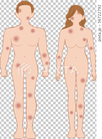 化膿　全身　前　男女セット 56722792