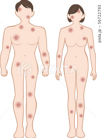 化膿 全身 前 男女セット 化膿 全身 前 男女セット 56722793