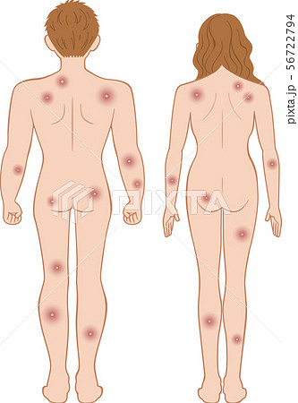 化膿 全身 後ろ 男女セット 化膿 全身 後ろ 男女セット 56722794