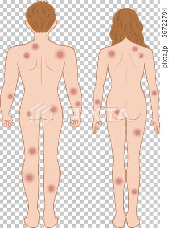 化膿 全身 後ろ 男女セット 化膿 全身 後ろ 男女セット 56722794