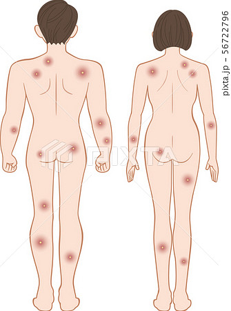 化膿　全身　後ろ　男女セット 56722796