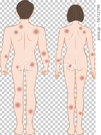 化膿　全身　後ろ　男女セット 56722796