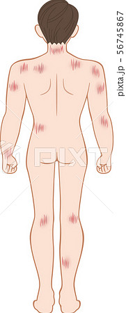ひっかき傷 全身 後ろ 男性のイラスト素材
