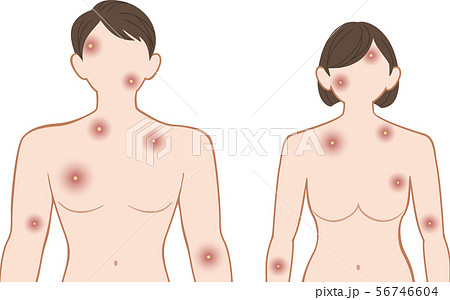 化膿　上半身　前　男女セット 56746604