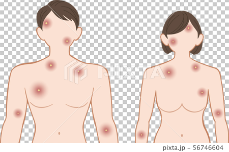 化膿　上半身　前　男女セット 56746604