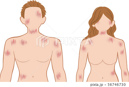 ひっかき傷 上半身 前 男女セットのイラスト素材