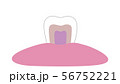 白い歯の内部イラスト - 透過png 56752221