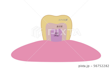 黄ばんで汚れのついた歯テキスト付き 56752282