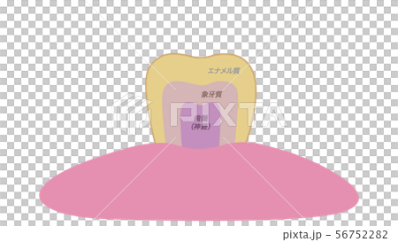 黄ばんで汚れのついた歯テキスト付き 56752282