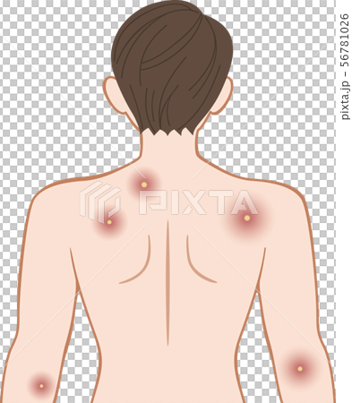 Title Festering upper body behind male 56781026