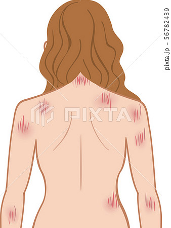 ひっかき傷 上半身 後ろ 女性のイラスト素材
