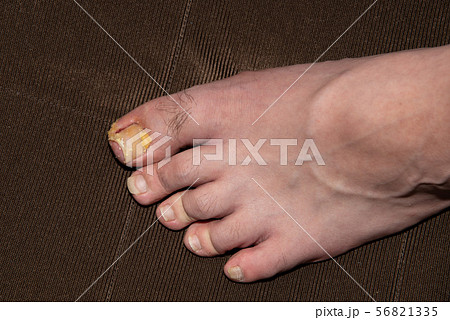 足爪 56821335
