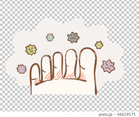 Illustration of foot athlete's foot 56829575