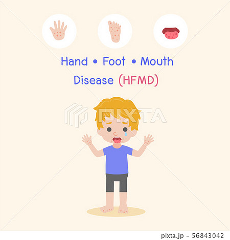 Hand, Foot, and Mouth Disease (HFMD) Medical 56843042