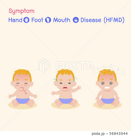 Hand, Foot, and Mouth Disease (HFMD) Medical 56843044