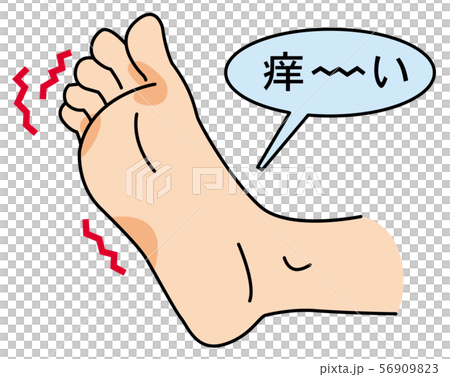 發癢的水運動員的腳 56909823
