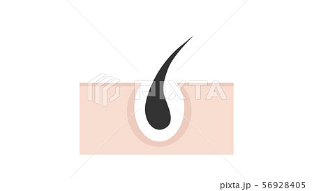 毛根（透過） 56928405