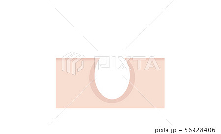 毛根（透過） 56928406