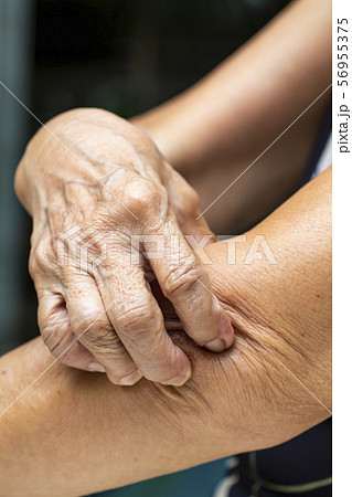Senior Woman's right hand scratching her left elbow, Bokeh background, Close up shot, Asian Body skin part, Healthcare concept Senior Woman's right hand scratching her left elbow, Bokeh background, Close up shot, Asian Body skin part, Healthcare concept 56955375
